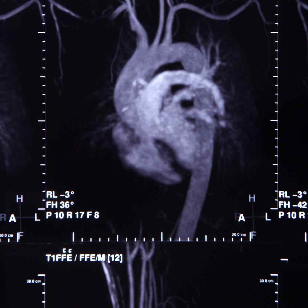inner_image_05 https://www.reypharmacy.co.uk/wp-content/uploads/2021/08/inner_image_05.jpg