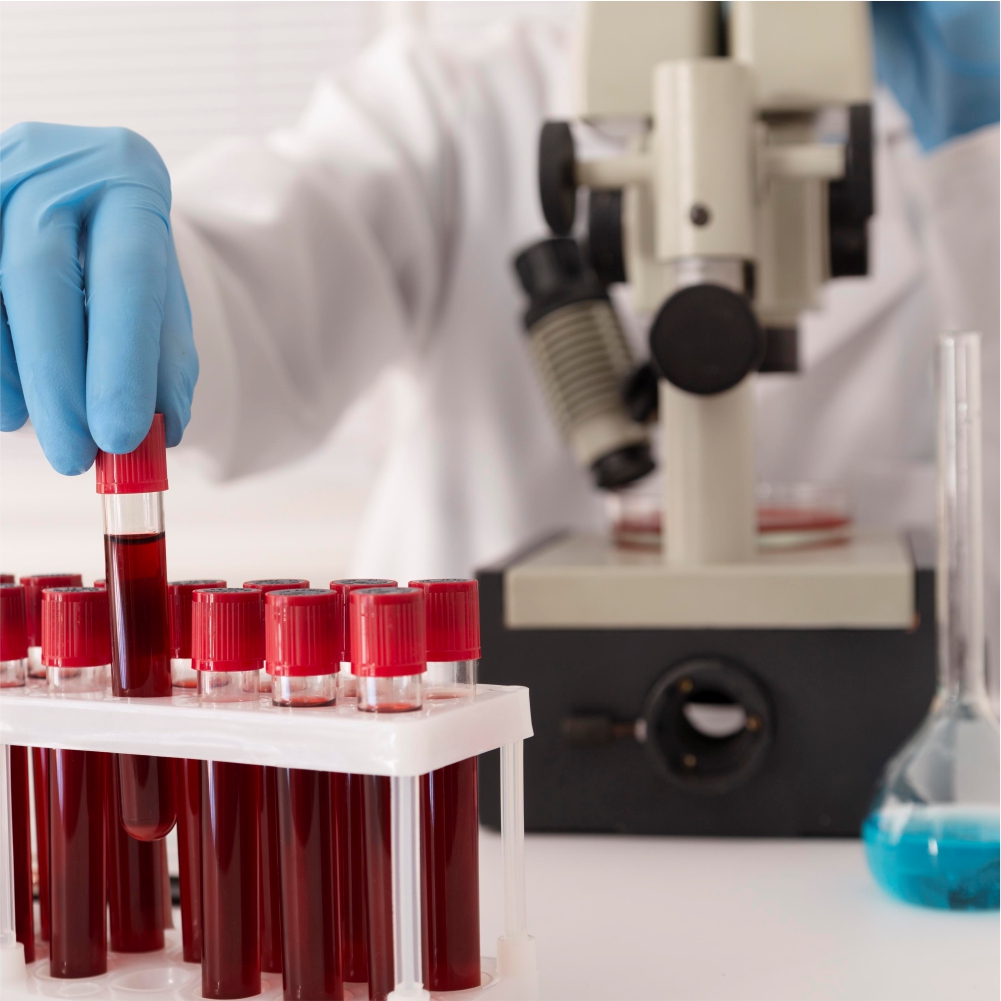 Health Screening & Testing https://www.reypharmacy.co.uk/wp-content/uploads/2026/07/Health-Screening-Testing.jpg